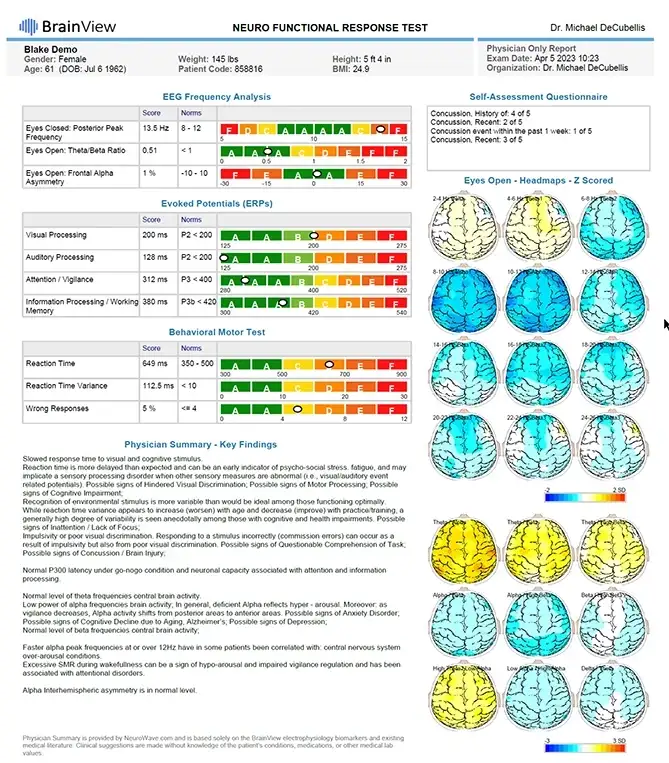 Chiropractic Downers Grove IL Brain View Sample
