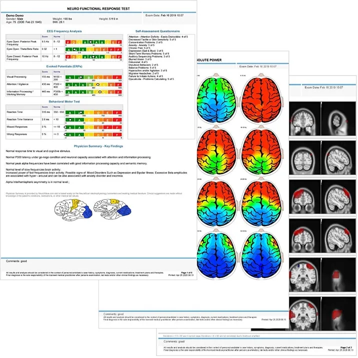 Chiropractic Downers Grove IL Brainview Report